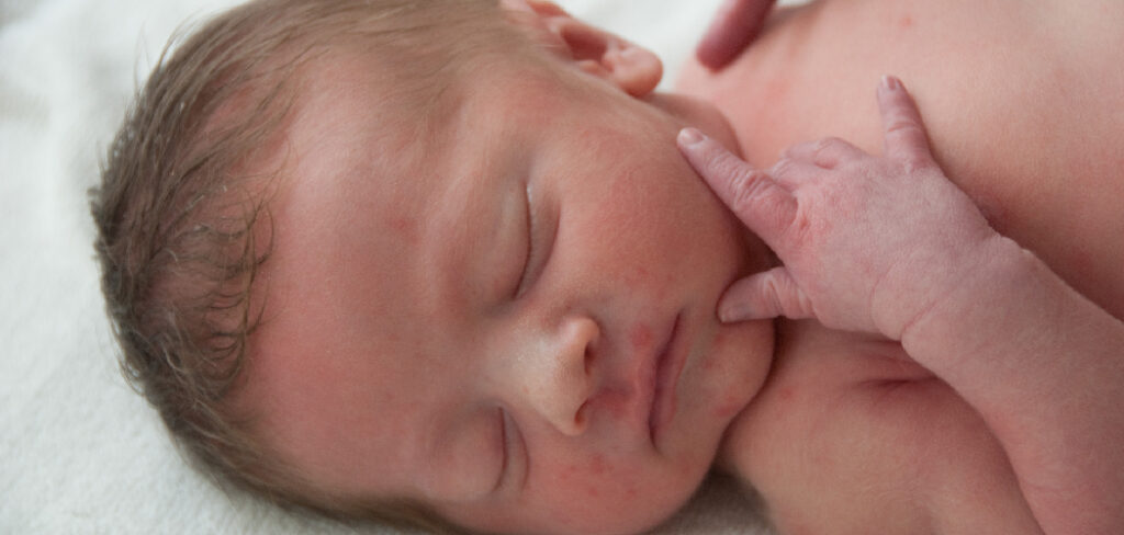 How to Use Baby Oil on Babies