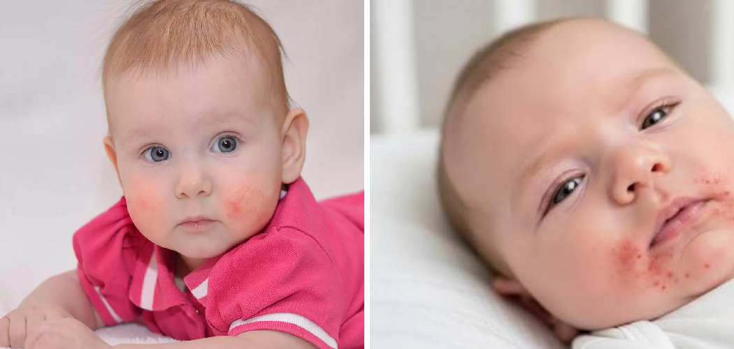 How to Test Peanut Allergy on Baby